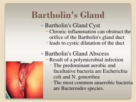 We promise we will keep you up to date. . Popping a bartholin cyst video
